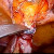 Laparoscopic Urogynecology