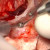 Department of Otolaryngology - Medical University of Warsaw