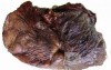 Lung Adenocarcinoma (5 of 5)