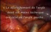 Laparoscopic Right Hemicolectomy