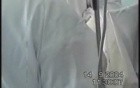 Pneumonectomy With Lymphadenectomy