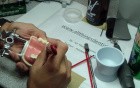 Anterior Bridge Preparation, Part 9 - Jet Provisional Reline
