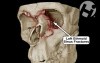 Volumated Facial Fractures