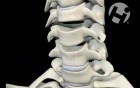 Anterior Cervical Discectomy with Fusion