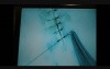 Microsurgery Tutorials. Lesson 3: Finesse. Mastering The Feel of Microsurgery. Petal Suture