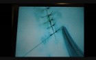 Microsurgery Tutorials. Lesson 3: Finesse. Mastering The Feel of Microsurgery. Petal Suture