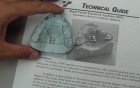 Slow/Rapid Palatal Expansion - Appliance Design