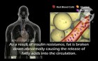 Diabetes: Type 2