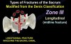 Sacral Fractures Classifications