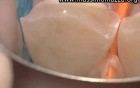 Value Of Microscopy In Prosthetic Dentistry