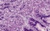 Gastric Fundus - Histology