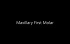 Maxillary First Molar - Root Canal Anatomy