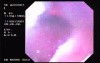 Oropharinx of a professional singer (2 of 2)