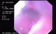 Oropharinx of a professional singer (2 of 2)