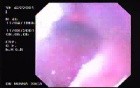 Oropharinx of a professional singer (2 of 2)