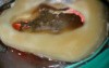 Guided detection of MB2 (CBCT)