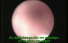 Ureteric Stone - Removal