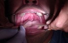 Say Ahhhhh