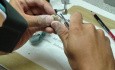 Temporary Bridge - Diamond Disks And Interproximal Areas