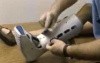 Lower Limb Immobilization