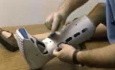 Lower Limb Immobilization