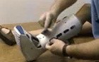 Lower Limb Immobilization
