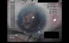 Cataract Surgery V - Part 4