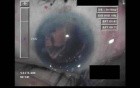 Cataract Surgery V - Part 4