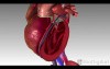 Congestive Heart Failure