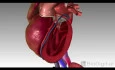 Congestive Heart Failure