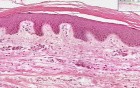 Thin Skin - Histology