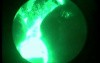 Greenlight HPS