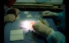 Hair transplantation surgery