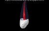 Maxillary Canine