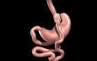 Gastric Bypass Animation