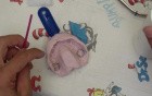 Rapid Palatal Expansion Device - Step 2