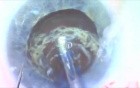 Multiple contrentric capsulotymy - an almost impossible maneuver 