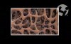 Effects of Accutane on Bone Strength