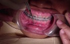 Ortho Patient RM - 7 Months