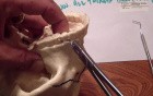 Ivy Loop Fixation - Maxilla Practice