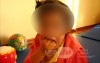 Rett Syndrome