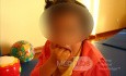 Rett Syndrome
