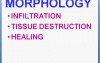 Inflammation - MSP - 2e