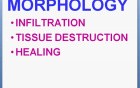 Inflammation - MSP - 2e