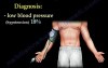Necrotizing Fasciitis - Video Lecture - Part 1
