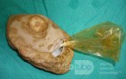 Intragastric Balloon Deteriorotated By Gastric Acid (2 of 3)