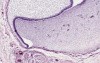Tooth Development - Histology