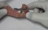 Implant Bar Overdenture - Model Demonstration