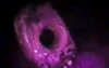 A toothbrush in the stomach