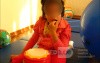 A Little Girl With Rett Syndrome